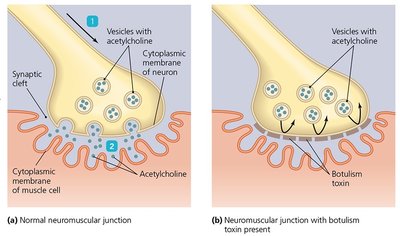 Muscle contraction in tetanus
