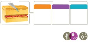 Diagram of inflammation phases