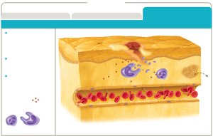 Diagram of resolution phase in inflammation