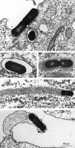 Listeria escaping phagosome
