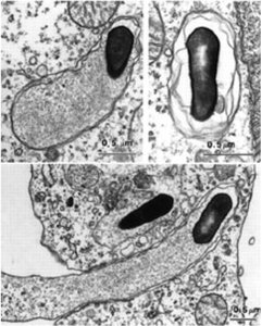 Listeria escaping phagosome