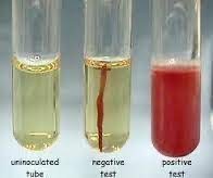 Soft agar motility test