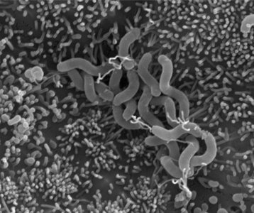 Helicobacter pylori colonizing stomach