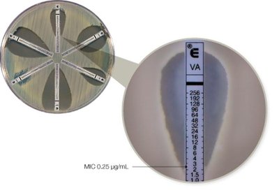 E-test for determining MIC