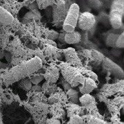 Electron micrograph of Rhodococcus cells