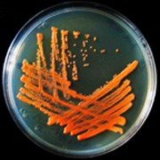 Rhodococcus colony on agar plate
