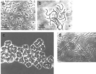 Morphological diversity of iron-oxidizing bacteria