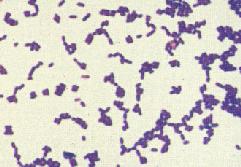 Gram-positive bacteria stained purple