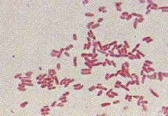 Gram-negative bacteria stained pink