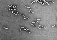 Darkfield microscopy example