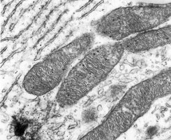 Transmission electron microscope (TEM)