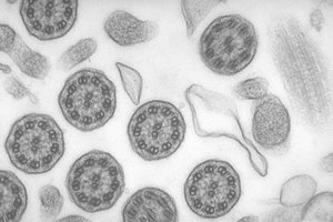 TEM image of internal cell structures