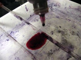 Application of stain to bacterial slide
