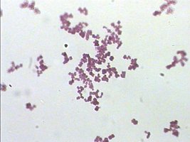 Microscopic image of stained bacteria under oil immersion