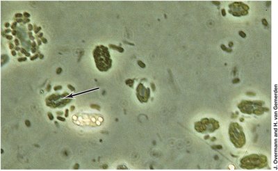 Phase-contrast micrograph of 'Pelochromatium roseum'