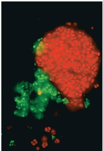 MAR-FISH image showing substrate uptake by different microbes