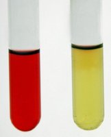 TSI Agar Lab Report Table