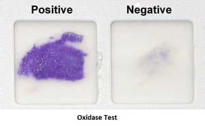 Citrate Test Tubes