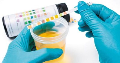 Urine dipstick test for UTI diagnosis