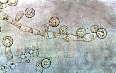 Candida hyphae and conidia under microscope
