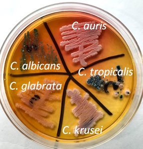 Candida species on agar plate
