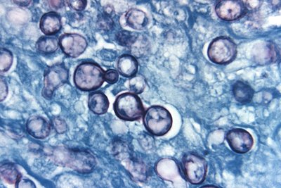 Histoplasma yeast form and macroconidia
