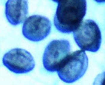 Pneumocystis life cycle diagram