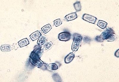 Coccidioides septate mycelium