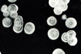 Coccidioides spherules with endospores