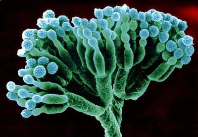 Penicillium conidiophore and conidia under microscope