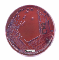 Bacterial growth on EMB agar