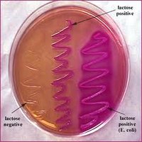 MacConkey agar with labeled lactose positive and negative