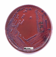 EMB agar with bacterial colonies