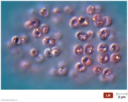 Sulfur deposits in purple sulfur bacteria