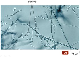 Branching filaments of actinomycetes