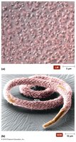 Legionella bacteria