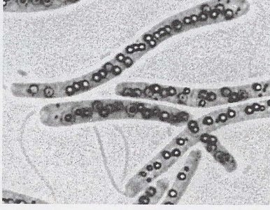 Sulfur globules in bacteria