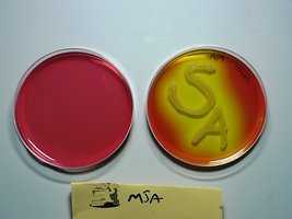 MSA plate showing mannitol fermentation (yellow) and no fermentation (red)