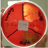 Blood agar plate divided into sections for alpha, beta, and gamma hemolysis
