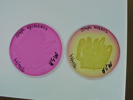 MSA plates: S. epidermidis (red, no fermentation) and S. aureus (yellow, fermentation)
