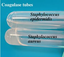 Coagulase test tubes: S. epidermidis (negative), S. aureus (positive)