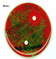 Blood agar plate with A and P disks for Streptococcus identification