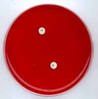 Blood agar plate with A and P disks (no growth)