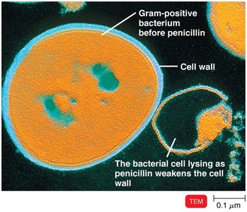 TEM showing Gram-positive bacterium lysing after penicillin treatment