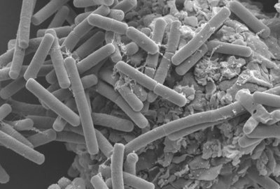 Bacterial colonies on solid media