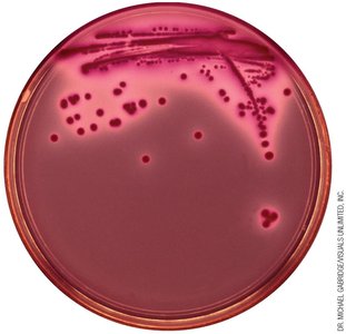 Bacterial colonies on agar plate