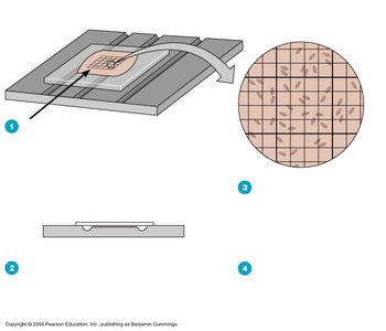 Direct microscopic count using a counting chamber