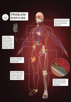 Biofilms and human health