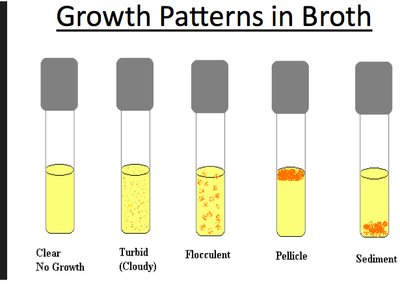 Growth patterns in broth