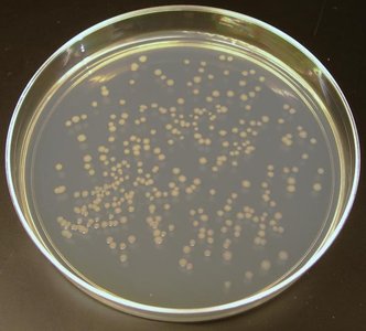 Agar slant tubes and plates